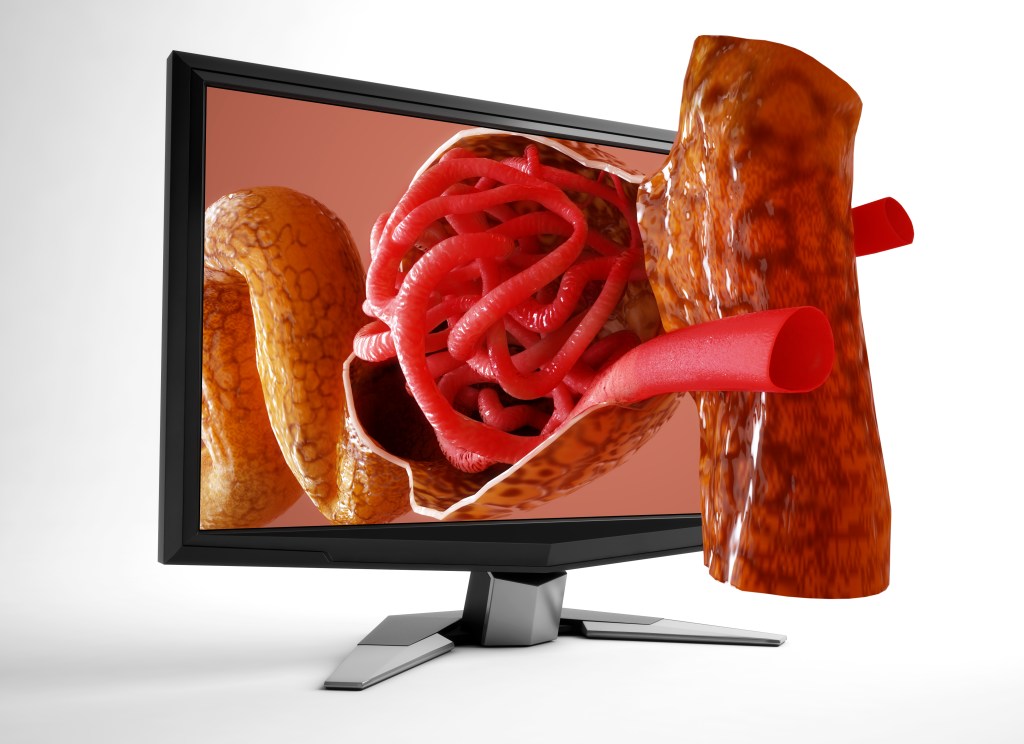 Monitor Glomeruli © Sensavis Visualization 2011